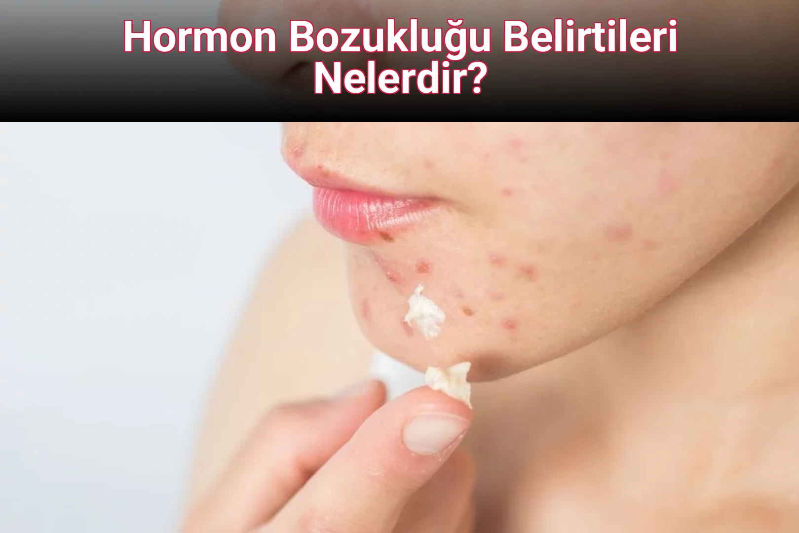 Hormon Bozukluğu Belirtileri Nelerdir?