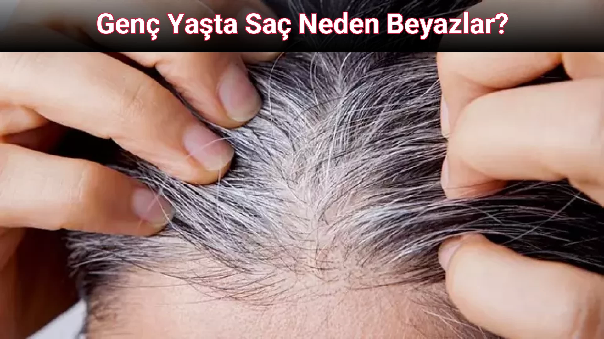 Genç Yaşta Saç Neden Beyazlar?