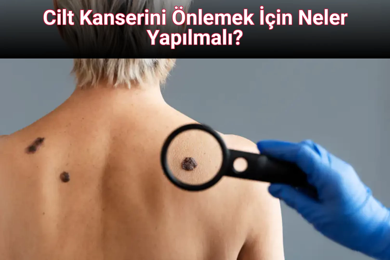 Cilt Kanserini Önlemek İçin Neler Yapılmalı?
