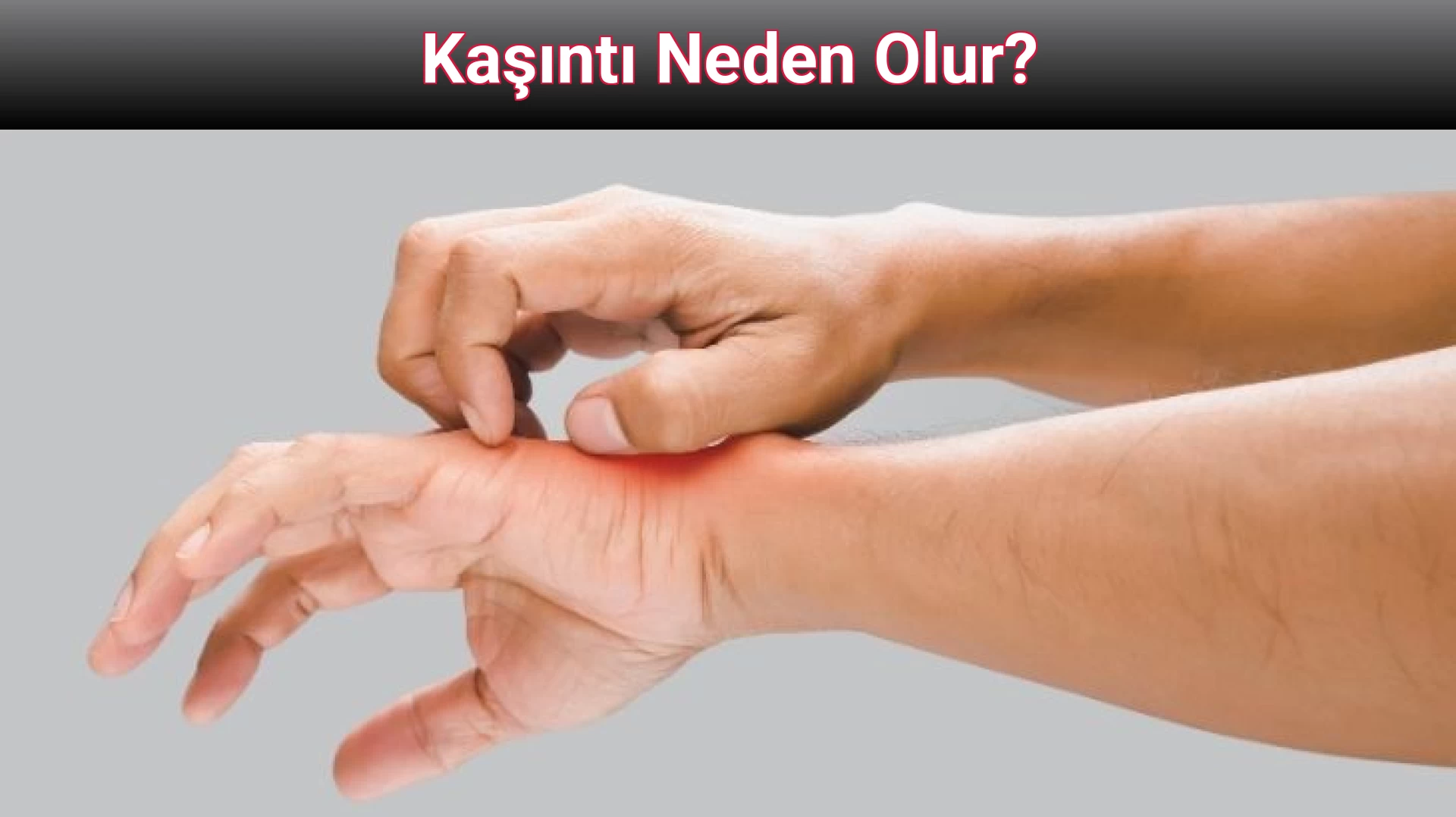 Kaşıntı Neden Olur?