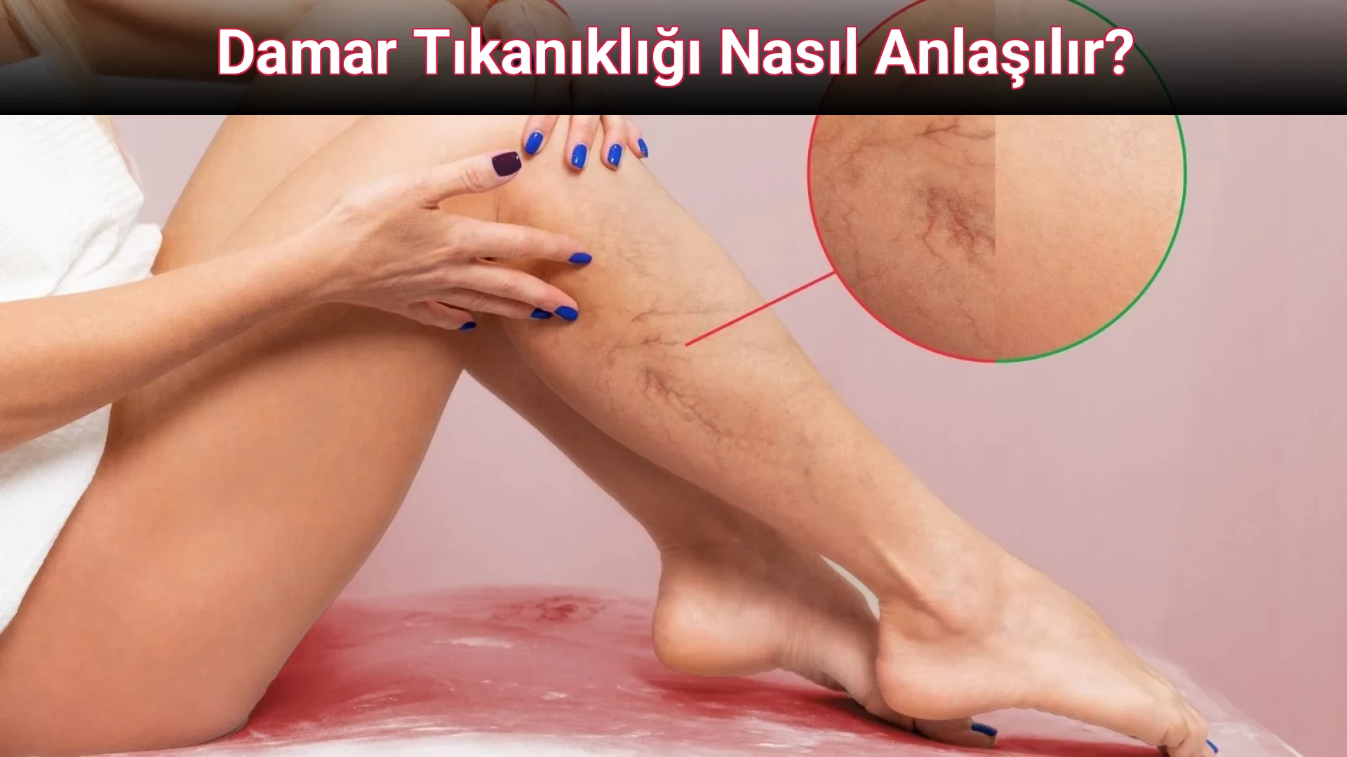 Damar Tıkanıklığı Nasıl Anlaşılır?