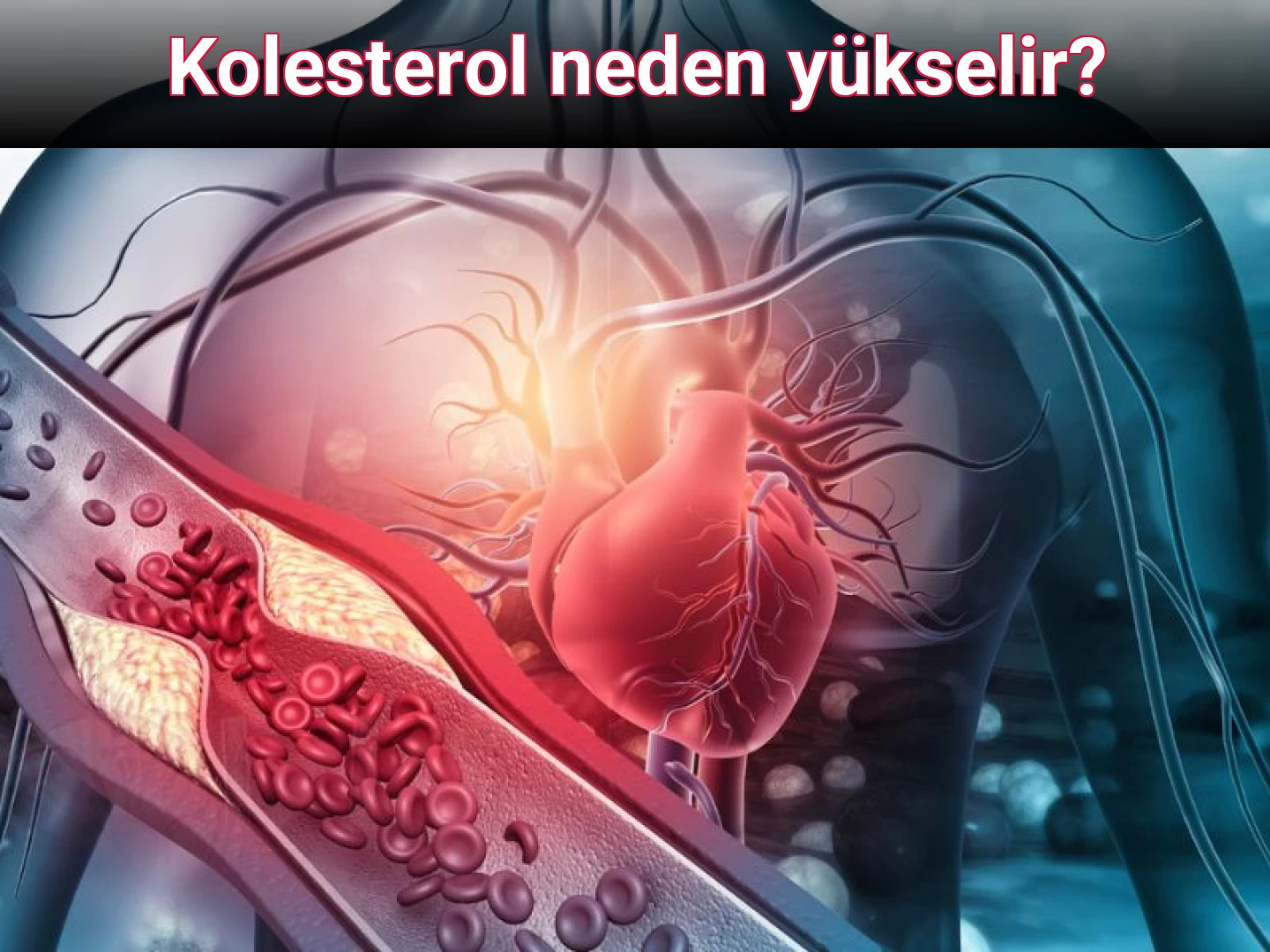 Kolesterol neden yükselir?
