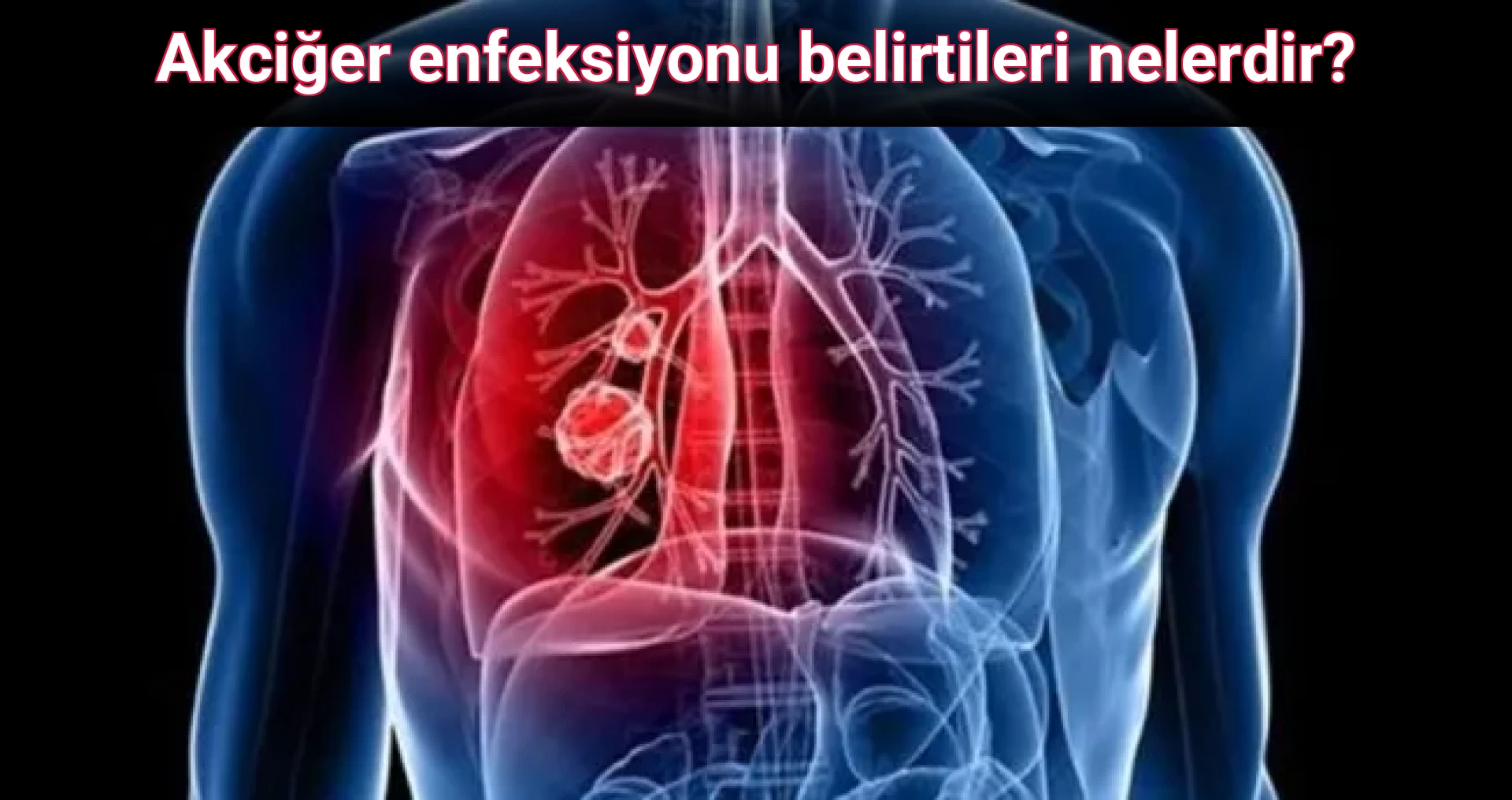 Akciğer enfeksiyonu belirtileri nelerdir?