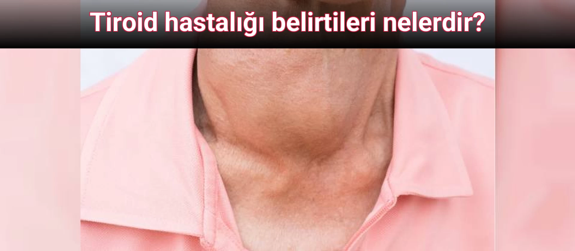 Tiroid hastalığı belirtileri nelerdir?