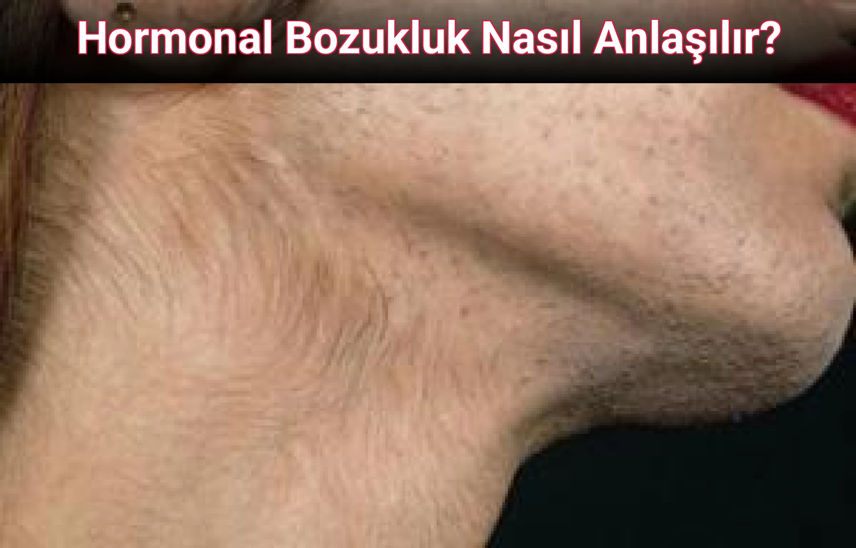 Hormonal Bozukluk Nasıl Anlaşılır?