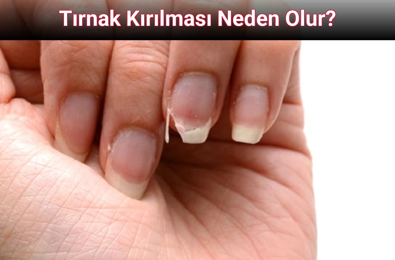 Tırnak Kırılması Neden Olur?