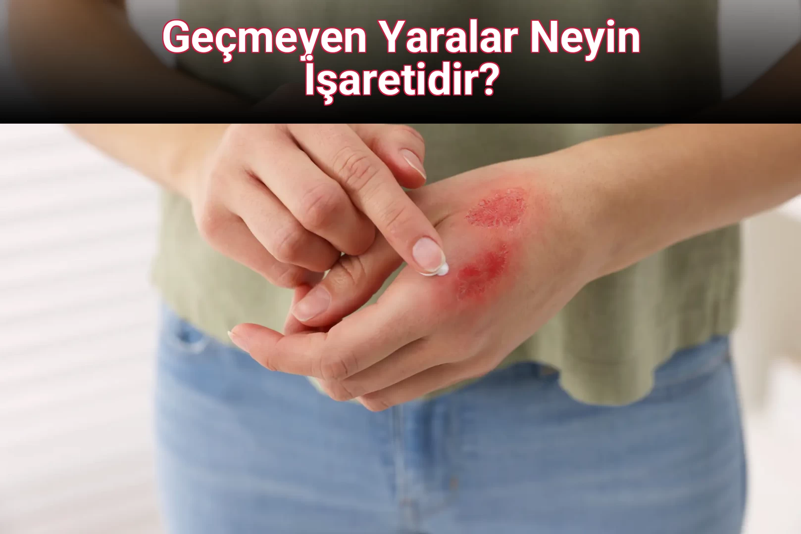 Geçmeyen Yaralar Neyin İşaretidir?