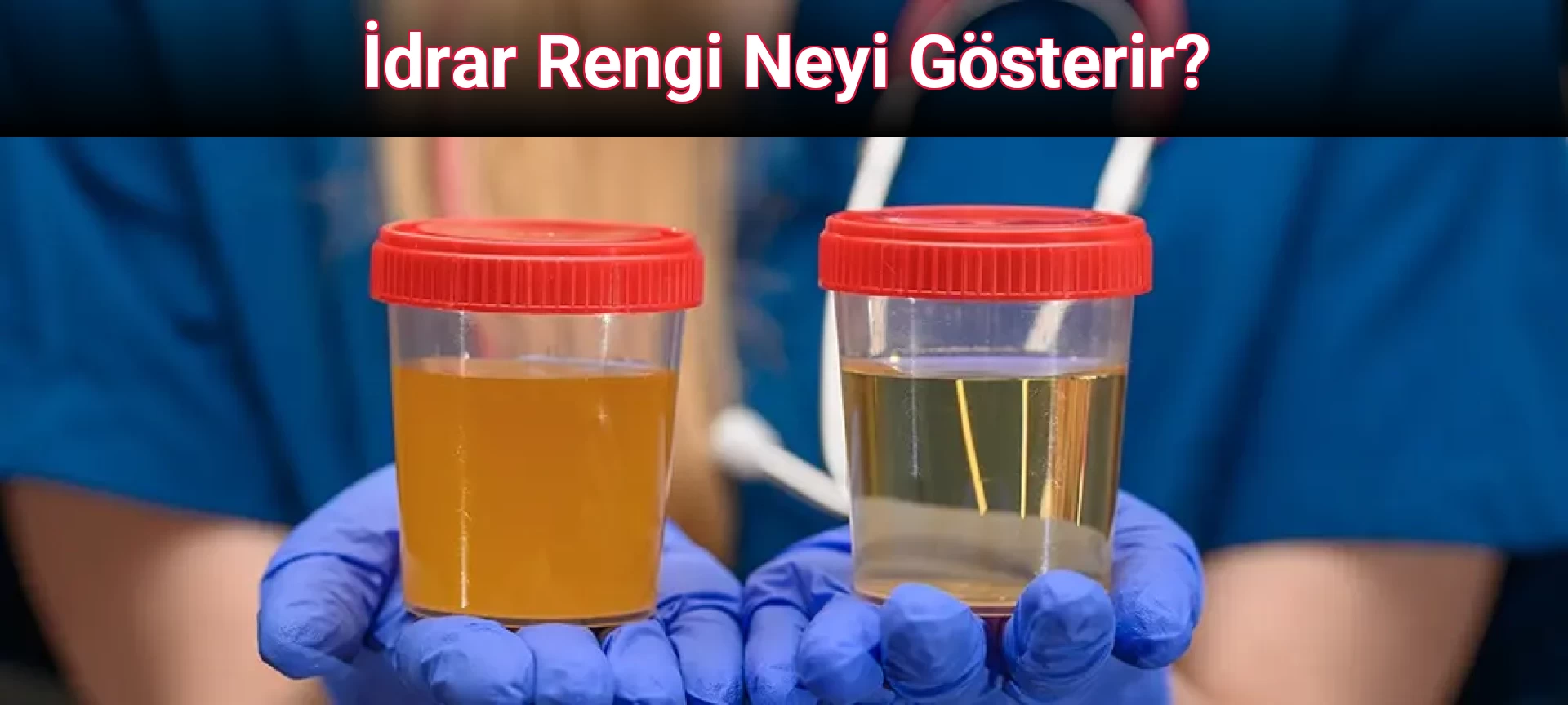 İdrar Rengi Neyi Gösterir?