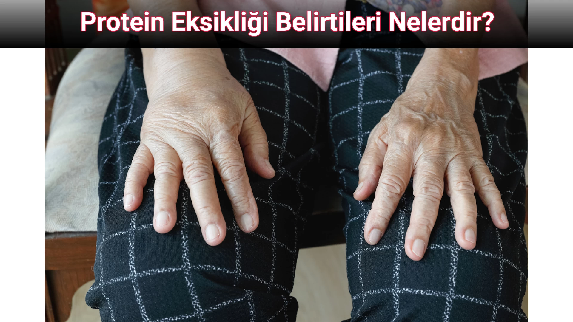 Protein Eksikliği Belirtileri Nelerdir?