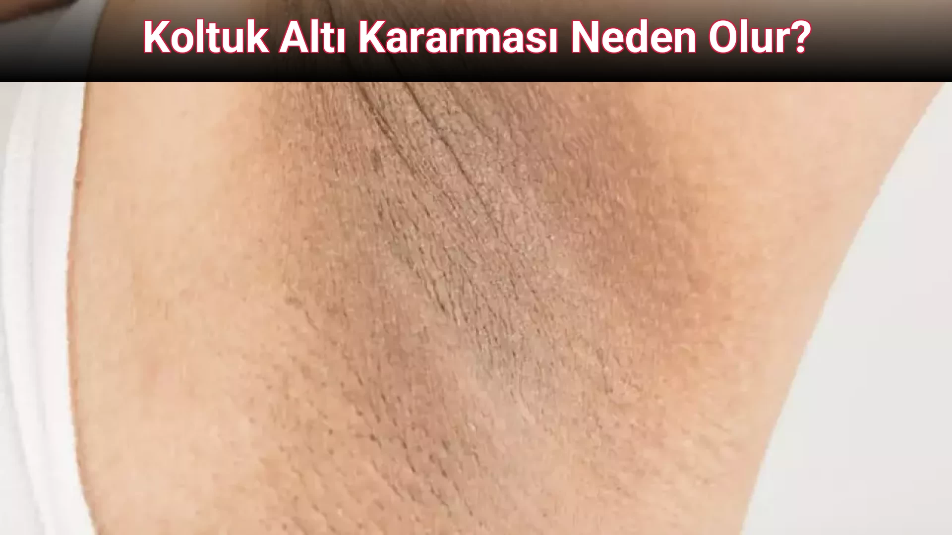 Koltuk Altı Kararması Neden Olur?