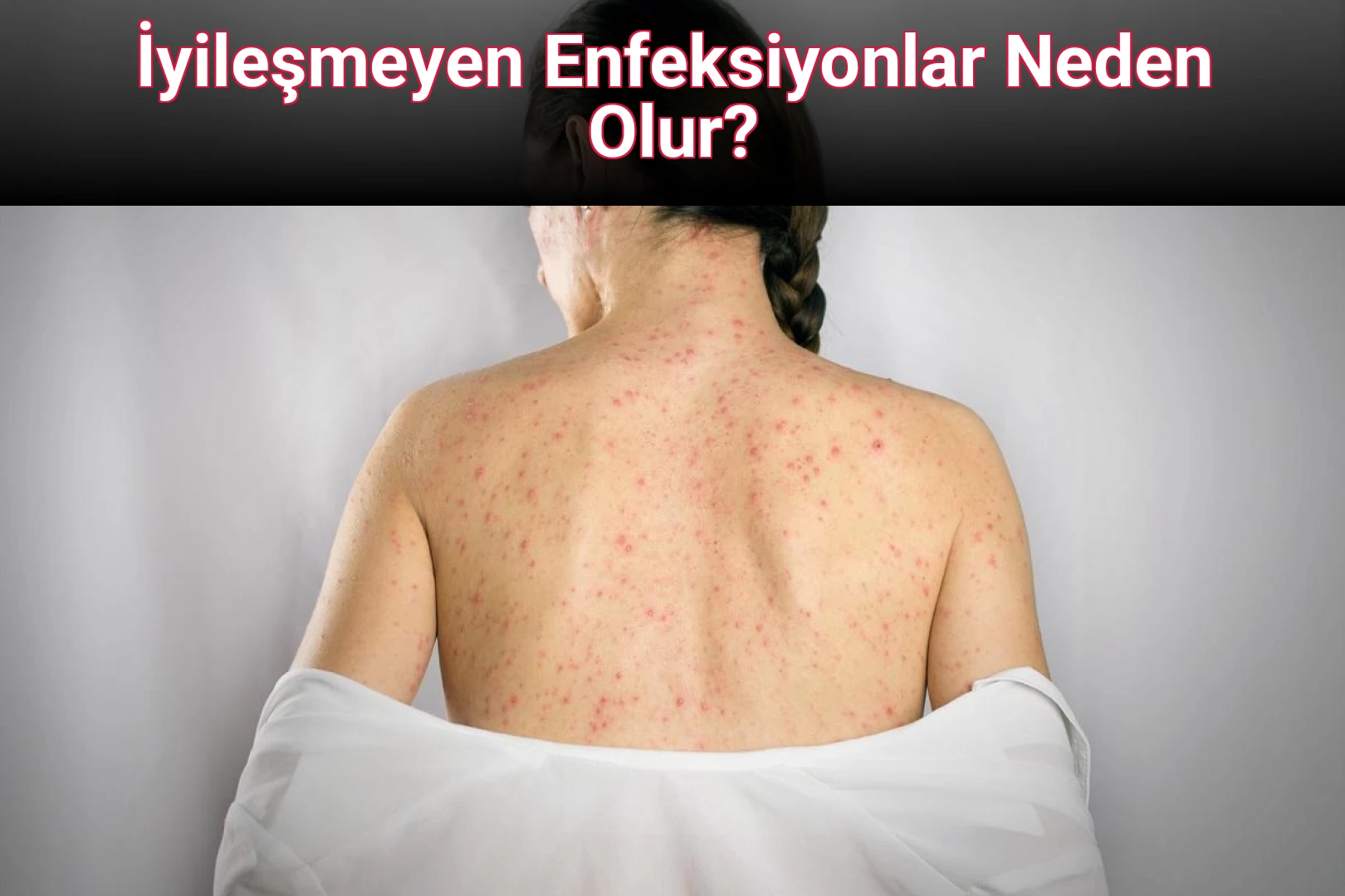 İyileşmeyen Enfeksiyonlar Neden Olur?