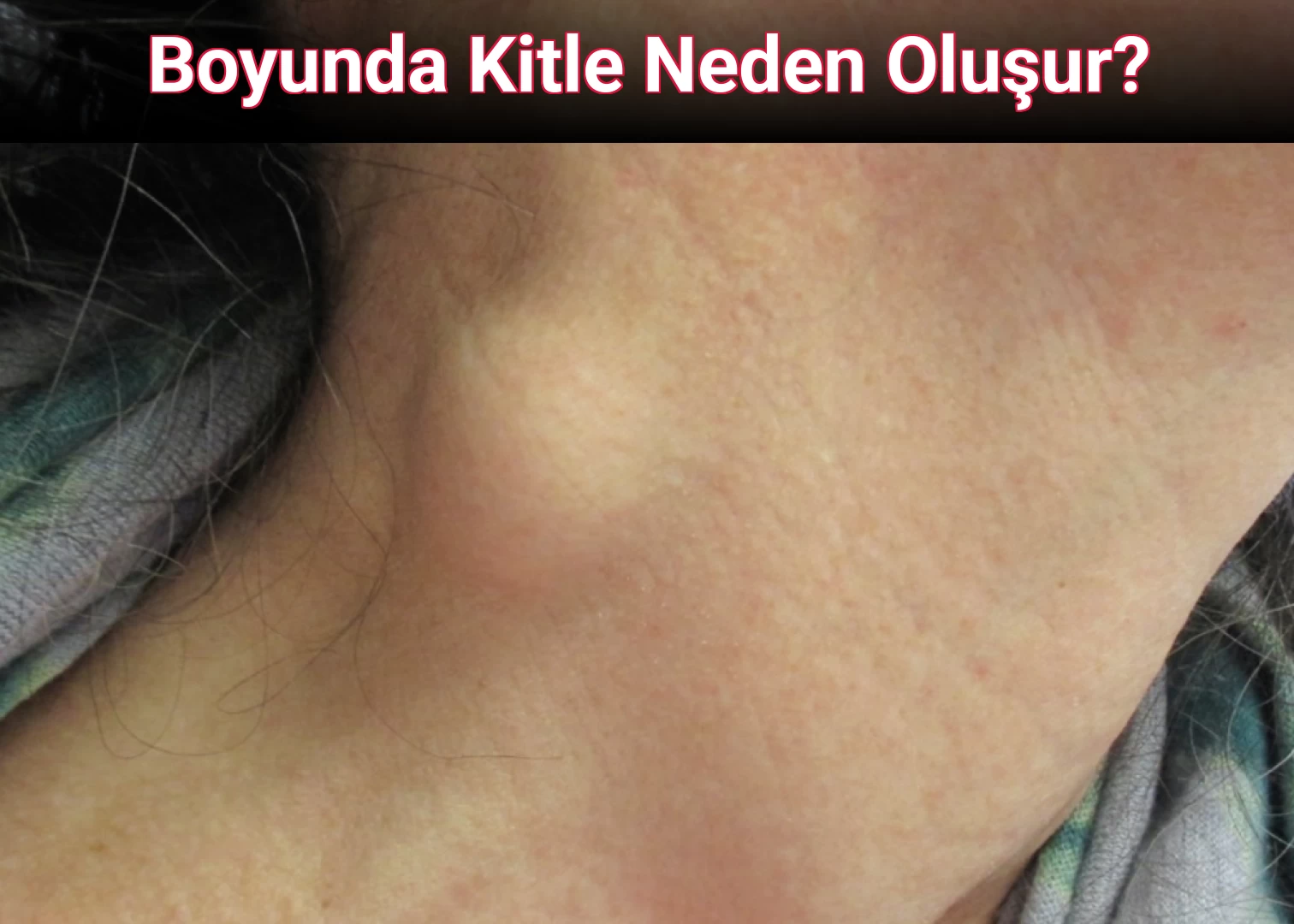 Boyunda Kitle Neden Oluşur?