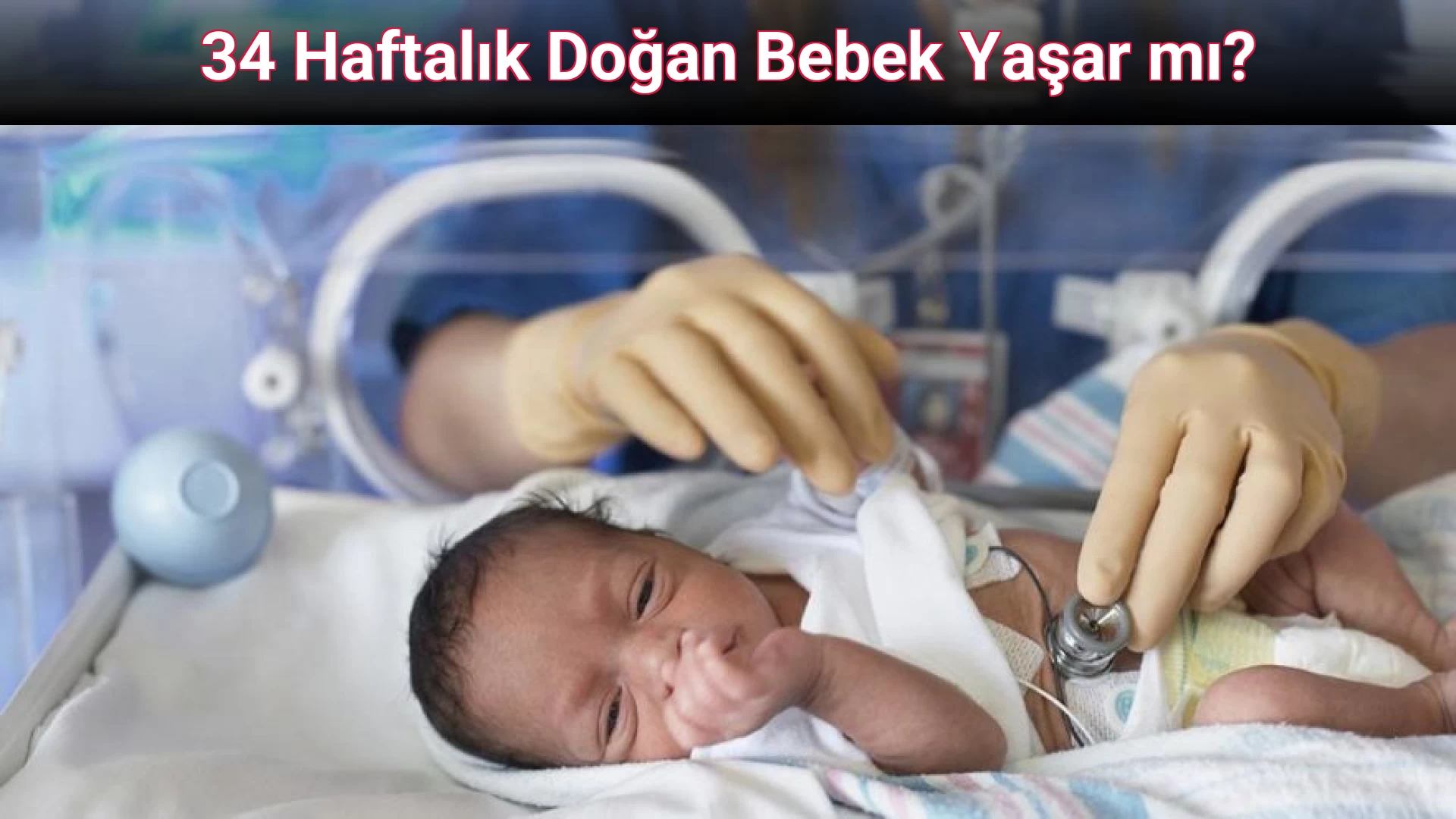34 Haftalık Doğan Bebek Yaşar mı?