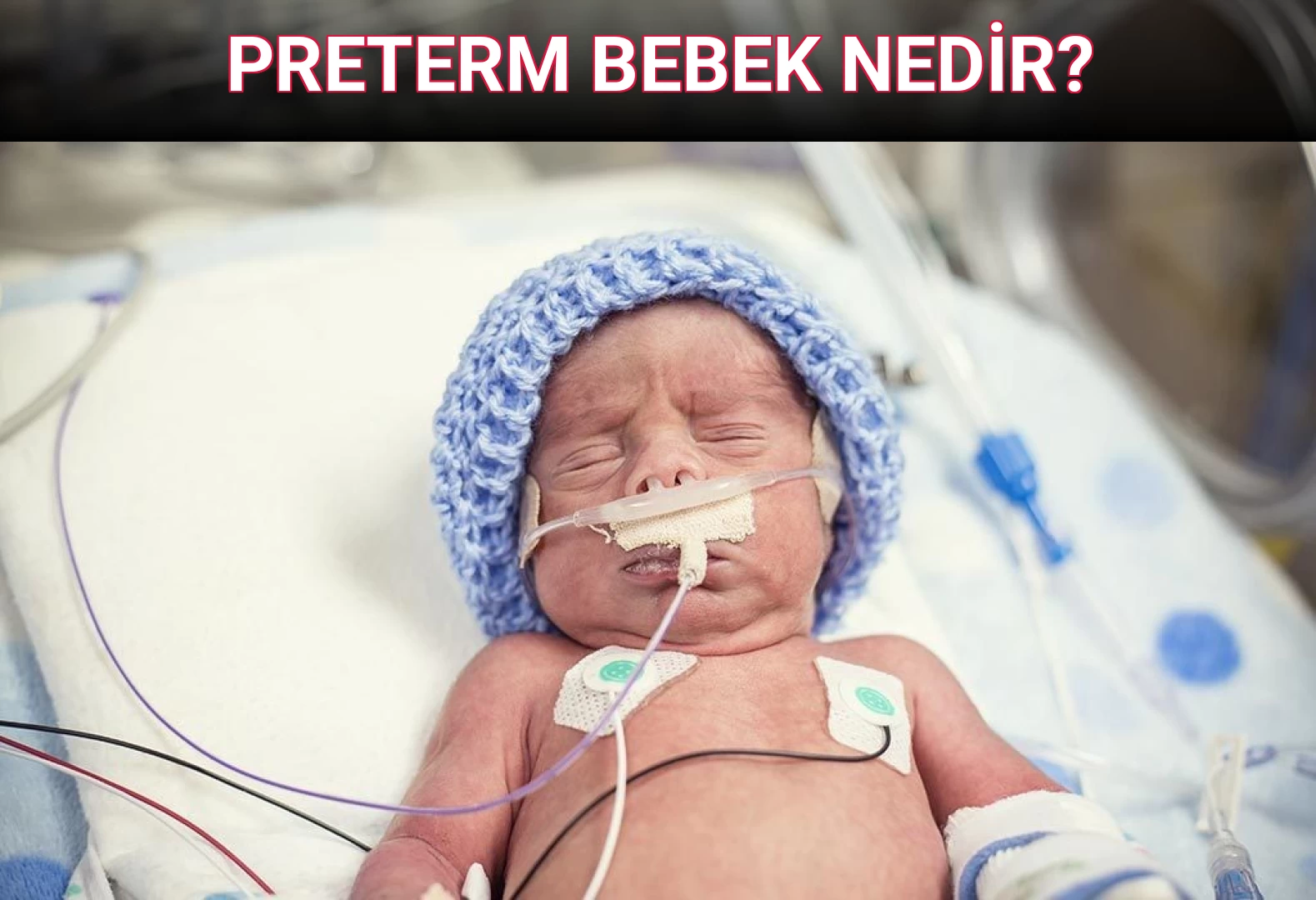 PRETERM BEBEK NEDİR?