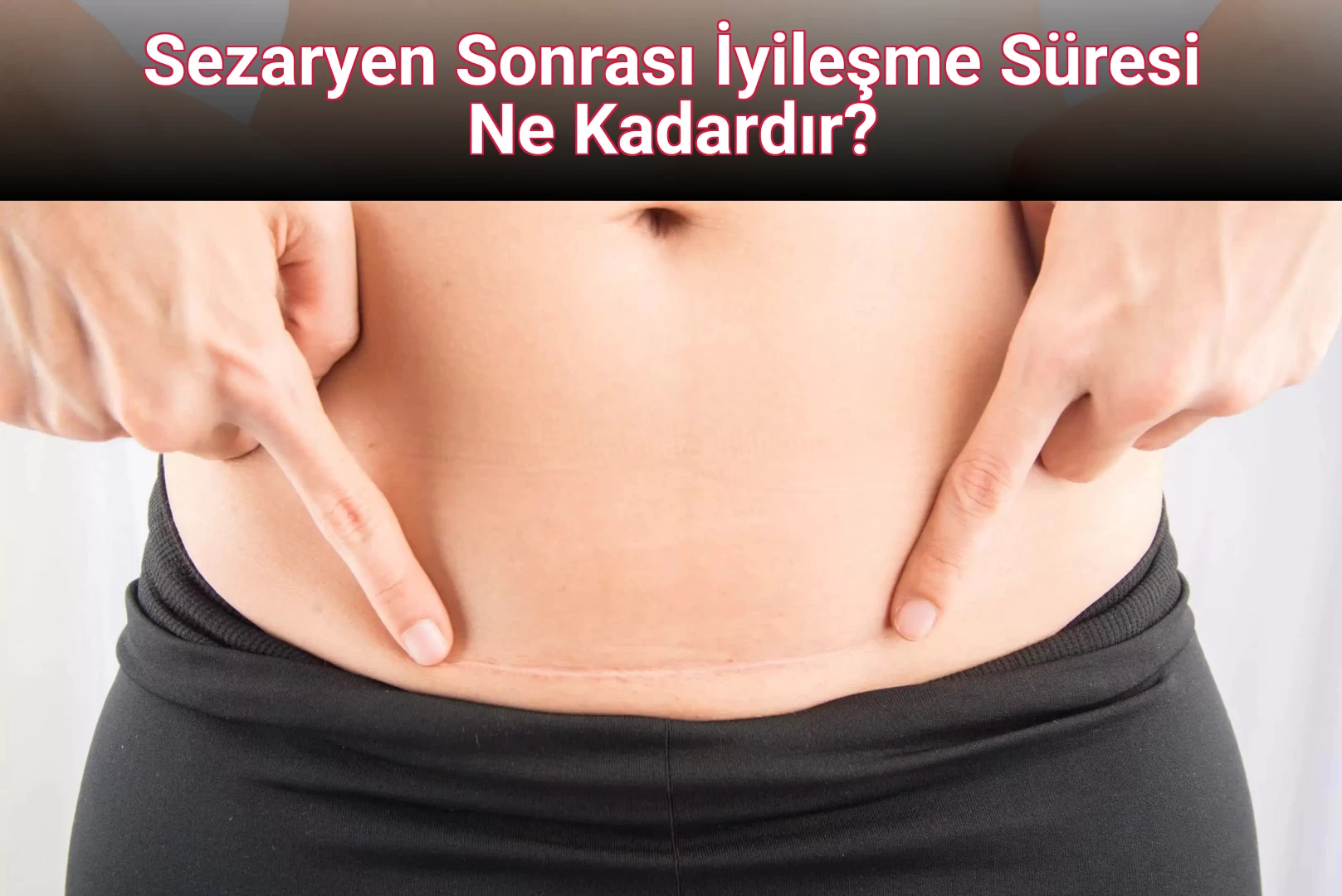 Sezaryen Sonrası İyileşme Süresi Ne Kadardır?