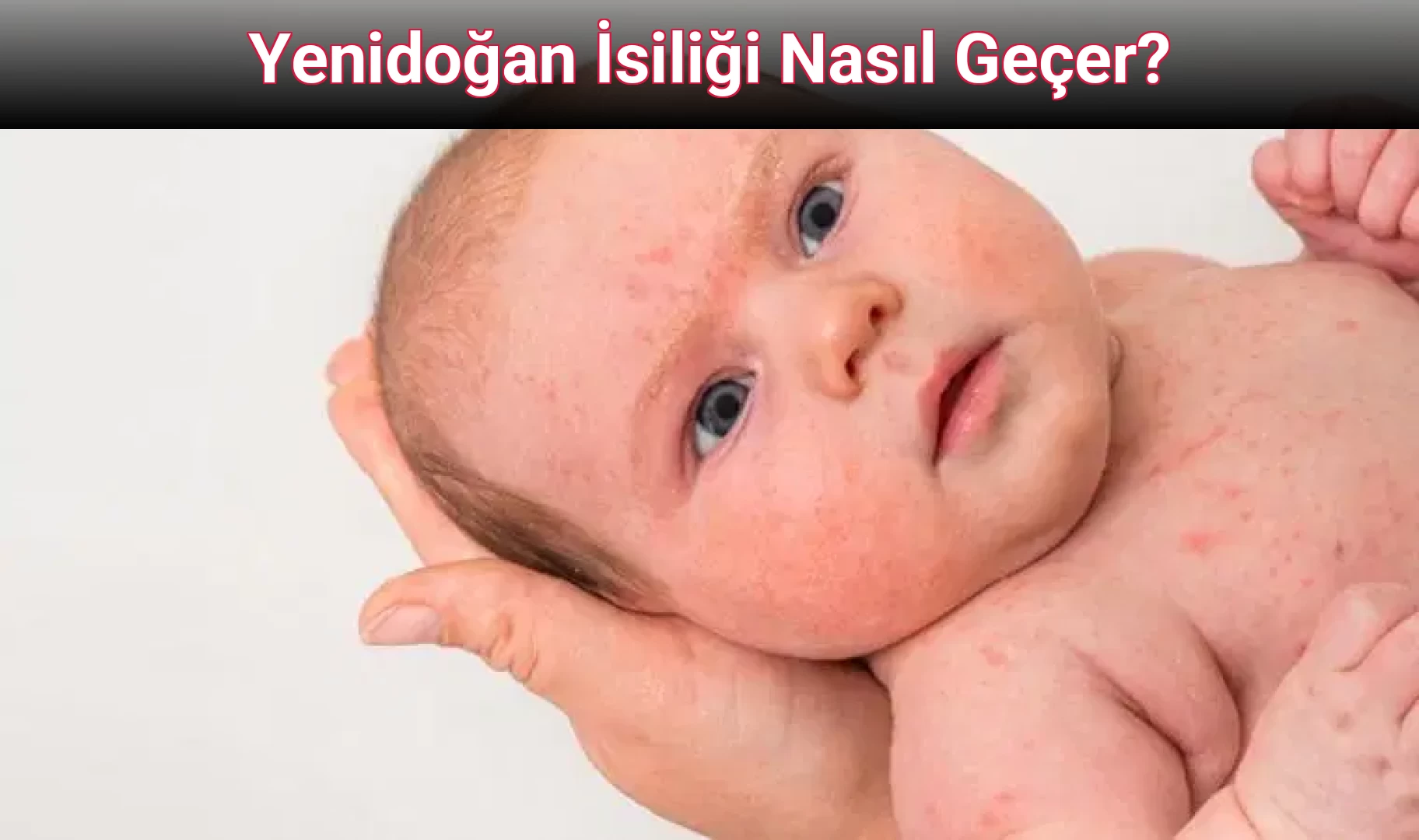 Yenidoğan İsiliği Nasıl Geçer?